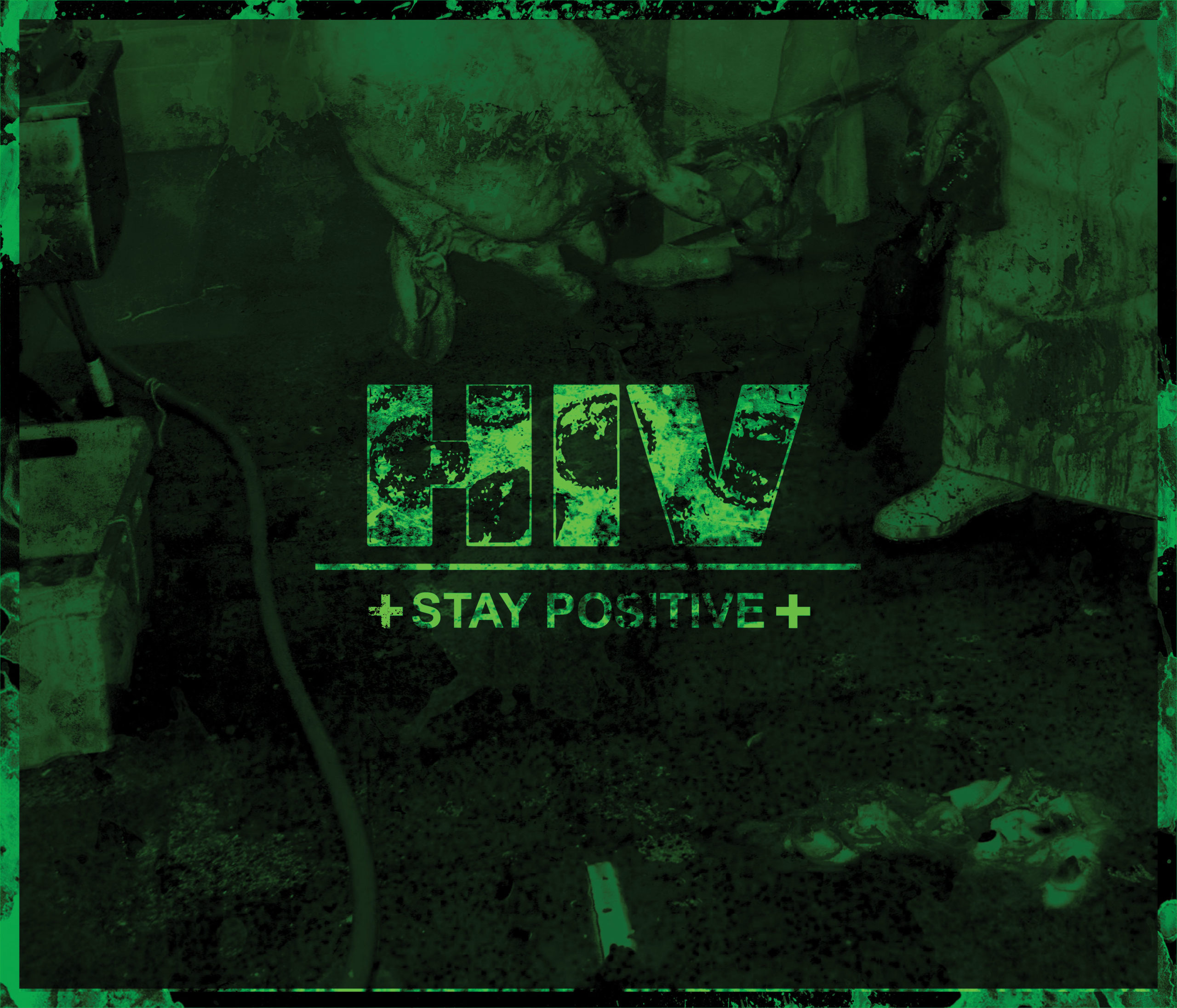 HIV